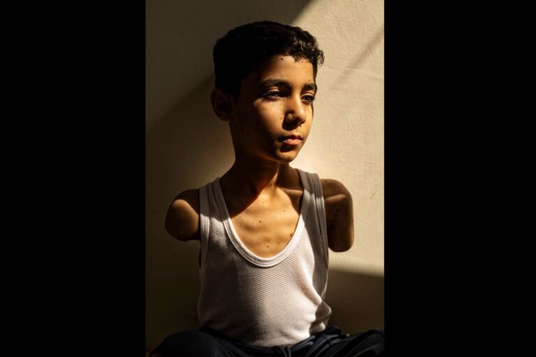 A moment of joy for a boy who lost both arms in an Israeli airstrike